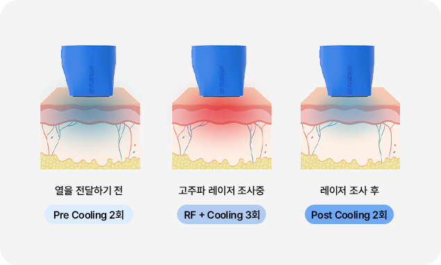 컨셉이미지